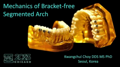 Mechanics of Bracket-free Segmented Arch