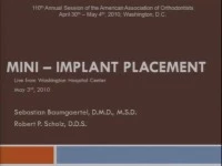 2010 Annual Session - Mini-Implant Placement - Live Clinical Procedure