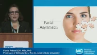 Facial Asymmetry: What are the Limits?