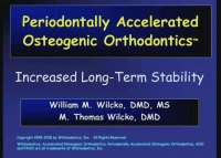 Long Term Results of Periodontally Accelerated Osteogenic Orthodontic Procedures