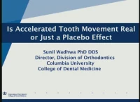 Is Accelerated Tooth Movement Real or Just a Placebo Effect?