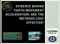 Evidence Behind Tooth Movement Acceleration: Are the Methods Cost Effective?