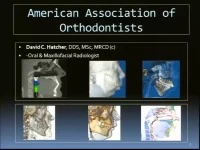 2013 Annual Session - CBCT: Identification of Anatomic Boundary Conditions Important to Orthodontists / Orthodontic Complications Seen in 3-D