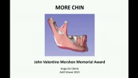 2022 John Valentine Mershon Award Lecture; More Chin