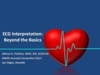 EKG Interpretation: Beyond the Basics
