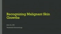 Recognizing Malignant Skin Growths