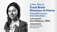  New Way to Treat Brain Diseases at Home Using Noninvasive Brain Stimulation