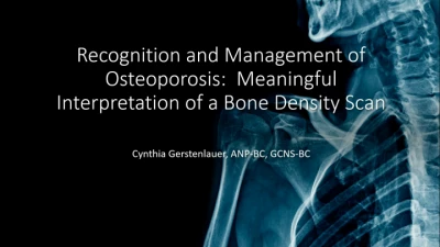 Recognition and Management of Osteoporosis